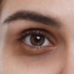 Natural Remedies for Dark Circles
