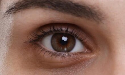 Natural Remedies for Dark Circles