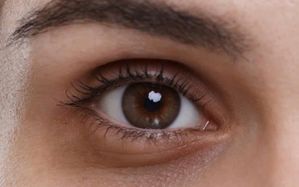 Natural Remedies for Dark Circles