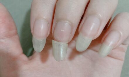 Why Your Nails Keep Breaking