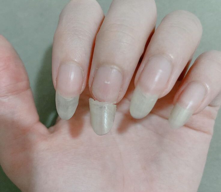 Why Your Nails Keep Breaking
